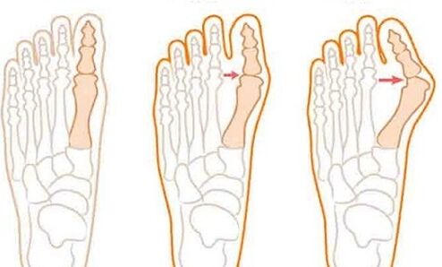 To develop the foot